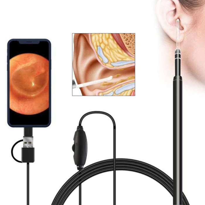 i95 3 in 1 USB Ear Scope Inspection HD 0.3MP Camera Visual Ear Spoon for OTG Android Phones & PC ...