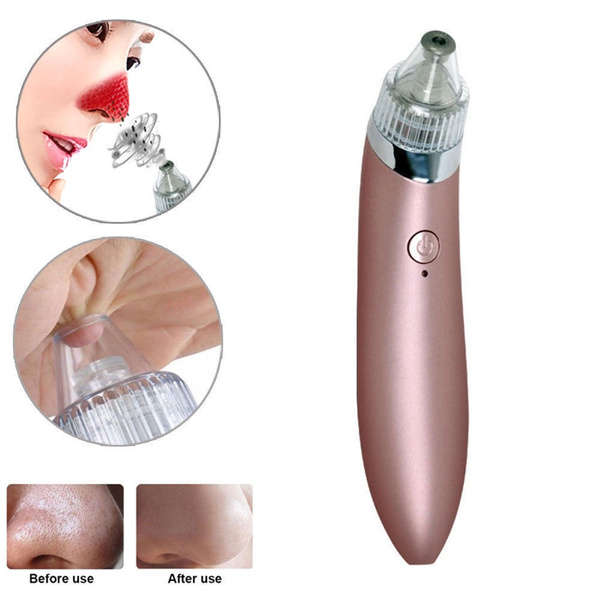 (Black Dots Extractor )  Electric Facial Pore Cleanser Blackhead Remover Vacuum Suction Machine
