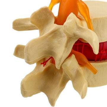 Medical Lumbar Vertebrae Model Props Anatomical Spine Herniation Teaching Tool