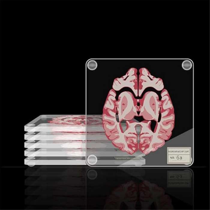 Brain Specimen Coasters Set 3D Organ Brain Artwork Brain Slices Square Acrylic Drinks Table Coaster