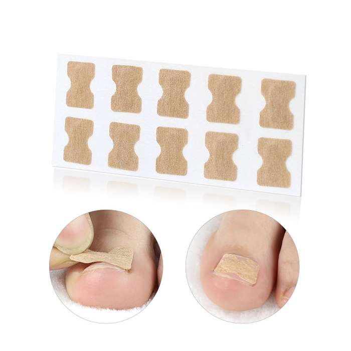 10 PCS Glue-free Orthopedic Nail Stick Toe Nail Groove Inlay Corrector(White Bottom)