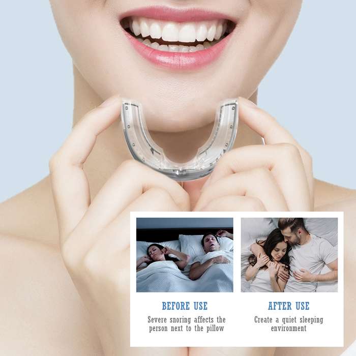 Sleeping Anti Snoring Mouth Guard Braces For Sleep Better Breath(White)
