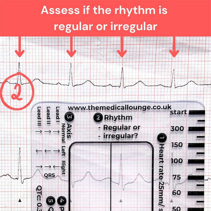 #1 - 2pcs ECG 7 Step Ruler Plastic Transparent EKG Calipers 7-Step Measuring Tool Waterproof and Eas