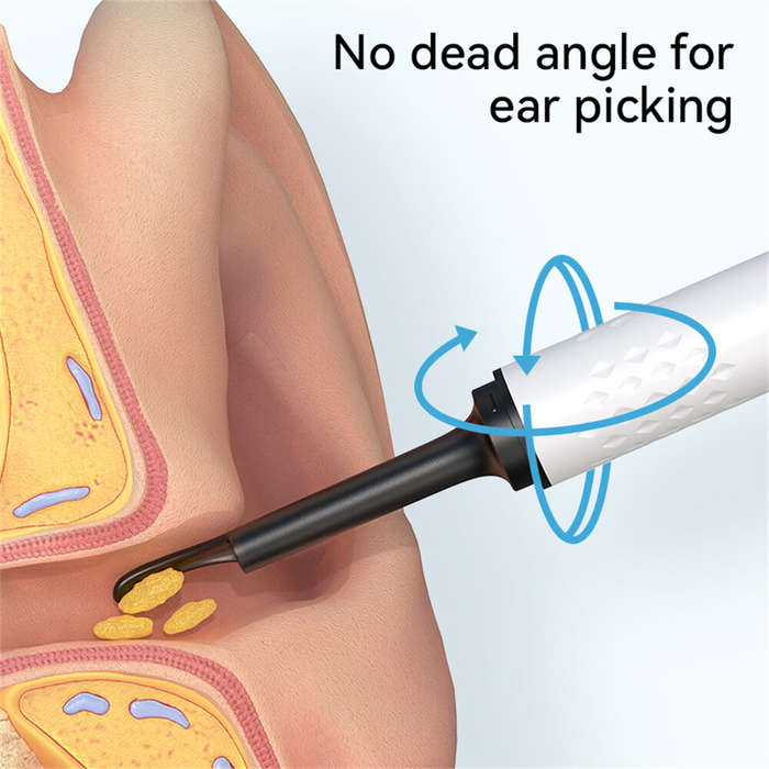 White - Smart Visual Ear Pick High Definition 5MP Camera Ear Spoon Endoscope Ear Digging Tool 360 Pr