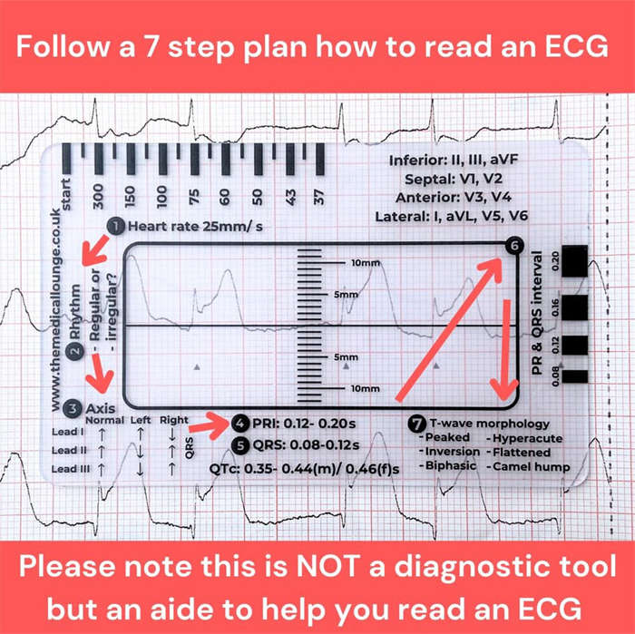 #1 - 2pcs ECG 7 Step Ruler Plastic Transparent EKG Calipers 7-Step Measuring Tool Waterproof and Eas