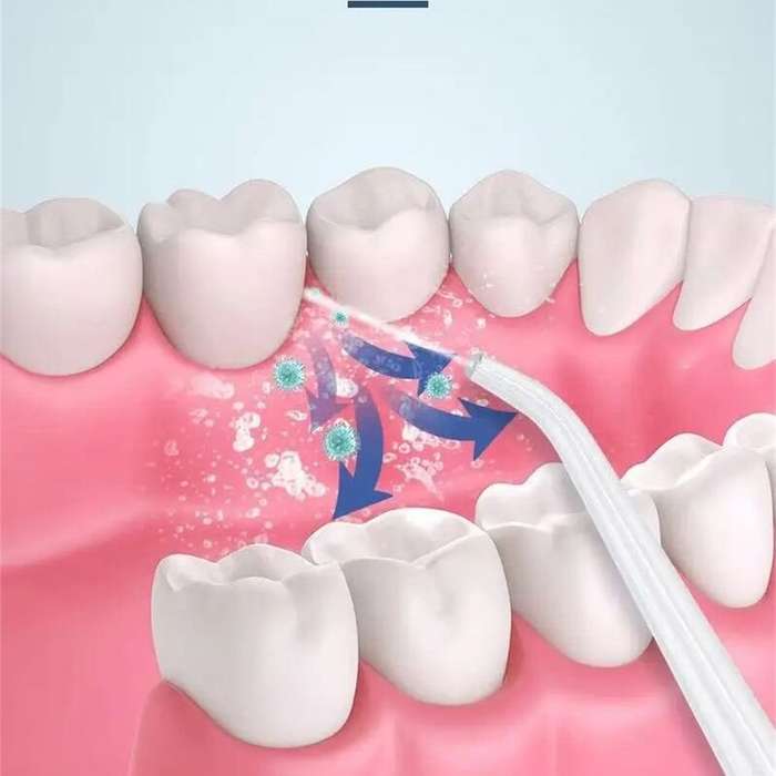 White - Cordless Dental Oral Irrigator with Adjustable Pressure Modes USB Rechargeable Water Flosser