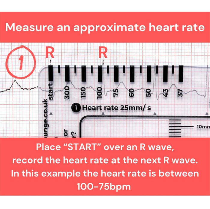 #1 - 2pcs ECG 7 Step Ruler Plastic Transparent EKG Calipers 7-Step Measuring Tool Waterproof and Eas