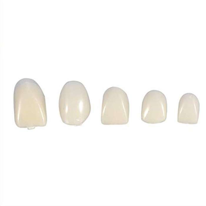 Temporary crowns, Teeth veneers, Anterior for front teeth