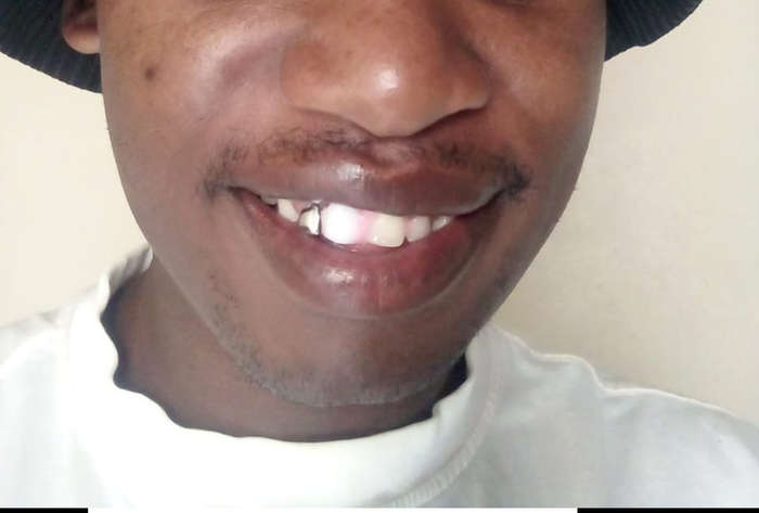 Perfect smile Cut-Able teeth veneers, suitable for top or bottom Cut & Use