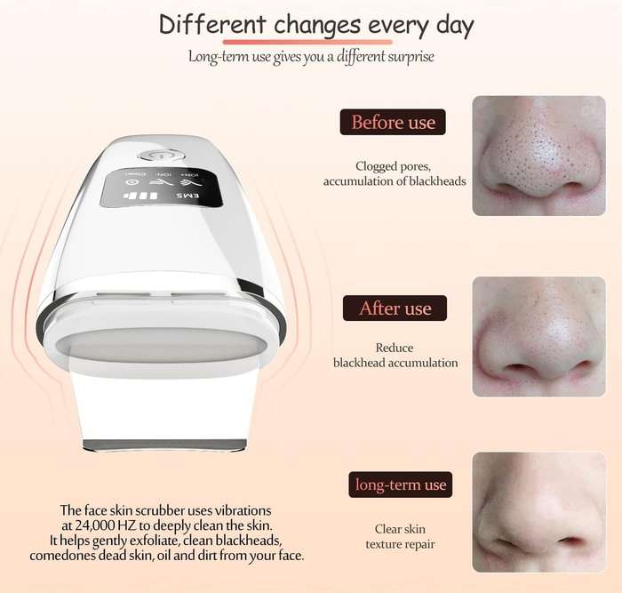 Ultrasonic Iron Facial cleansing Scrubber