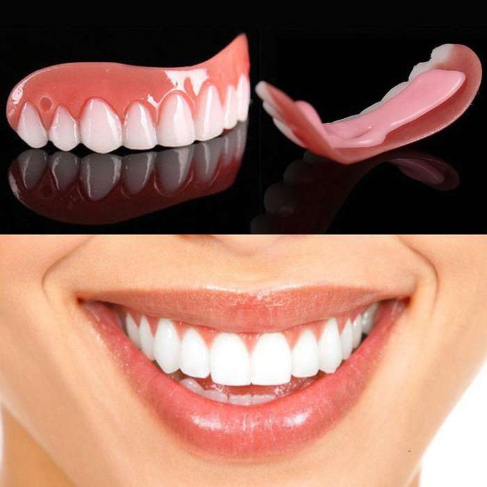 Top and Bottom - Incredible Teeth Veneers