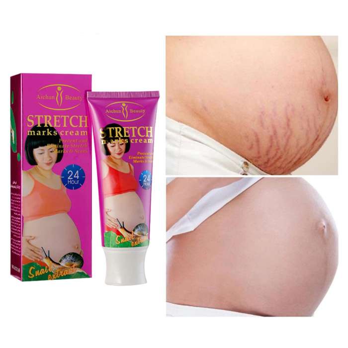 Snail Stretch Marks Cream