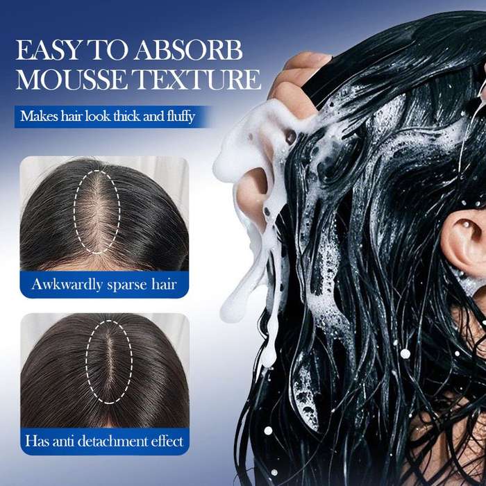 SADOER Minoxidil + Biotin Anti-Hair Loss Foam (5%)