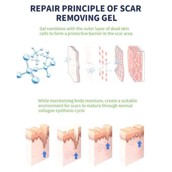 Asmoxa Silicone Gel for Scars  30g