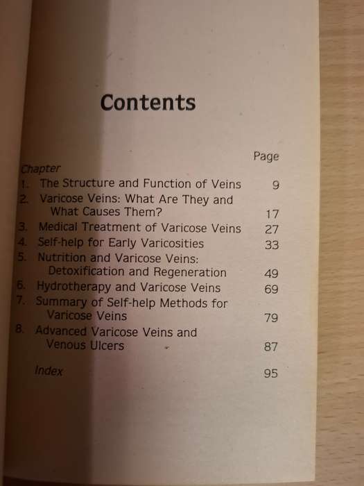 Varicose Veins : Leon Chaitow  (Paperback)