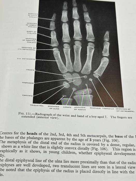 Surface and Radiological Anatomy: For Students and General Practitioners ~ Appleton 1958