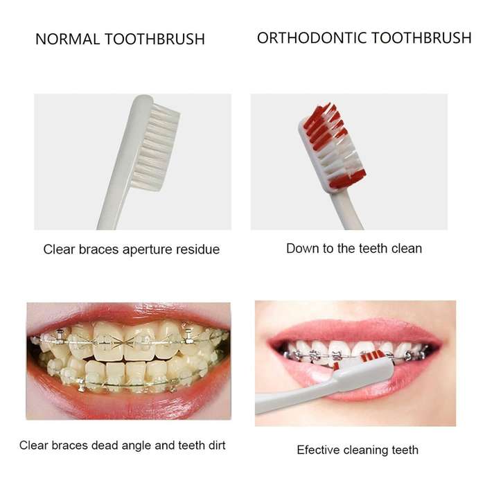 8 Piece Orthodontic Braces Care Kit