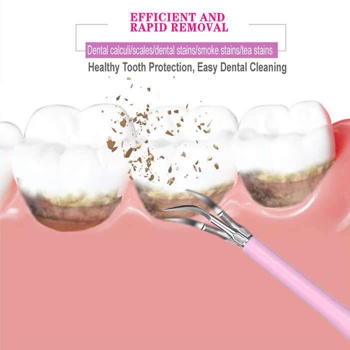Household Electric Tooth Cleaner Calculus Remover Dental Care Tool