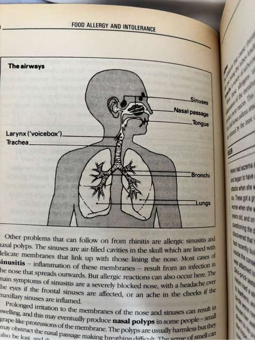 The Complete Guide to Food Allergy and Intolerance Professor Jonathan Brostoff and Linda Gamlin