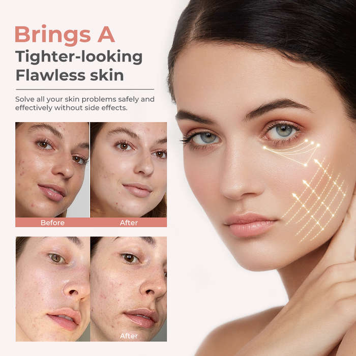 7 Colour Light Therapy Anti-Aging Skin Care Device