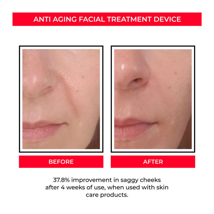 Facial Treatment Device for Enhancing Skin Care Absorption