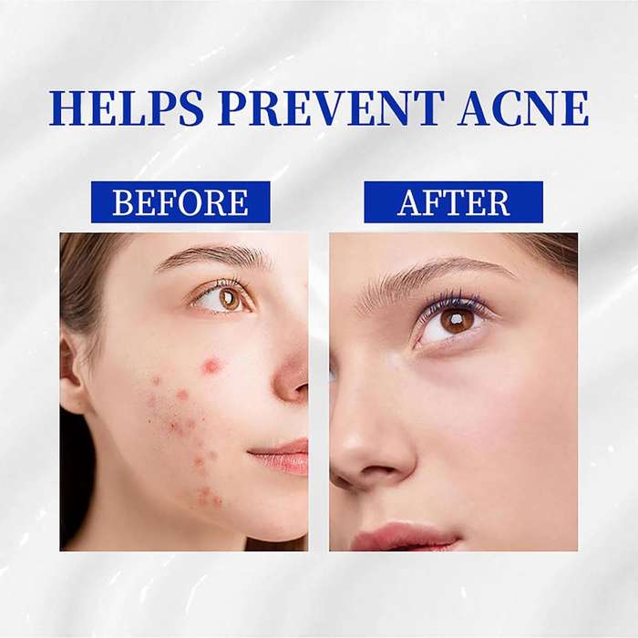 A~313 Vitamin A Retinol Cream, A Retinoids Lightweight 313 Face Cream for Anti-Aging, Reduce Wrinkle