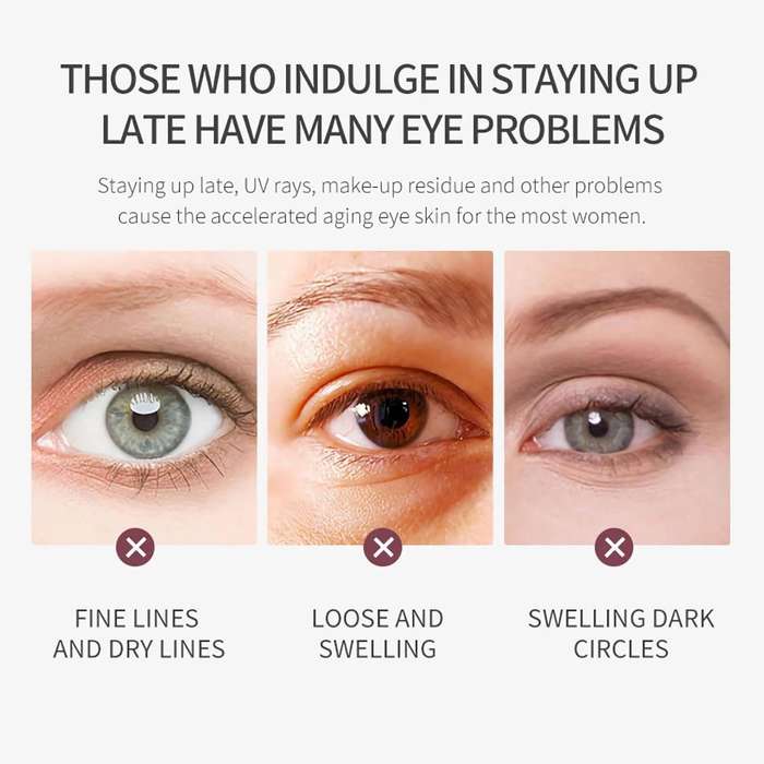 O'chleal Retinol Eye Cream Anti Aging, Under Eye Cream with Cooling Roller
