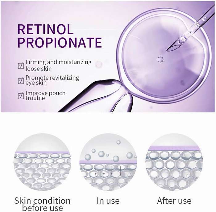 O'chleal Retinol Eye Cream Anti Aging, Under Eye Cream with Cooling Roller