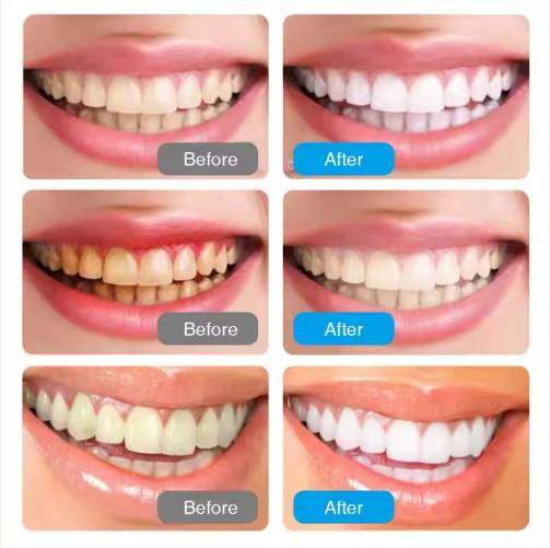 Toothpaste Teeth Whitening Gel Cleaning Care Tooth Paste