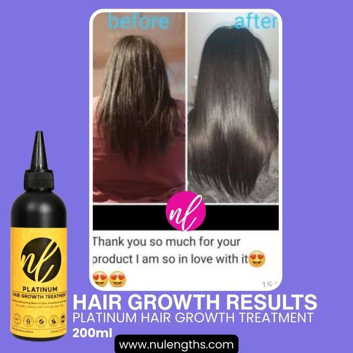 Platinum Hair Growth Treatment 50ml