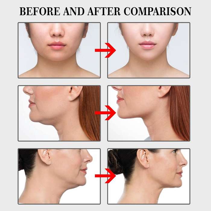 V-Shaped Invisible Tape Face Lift Tape for Wrinkles (40 Patches)