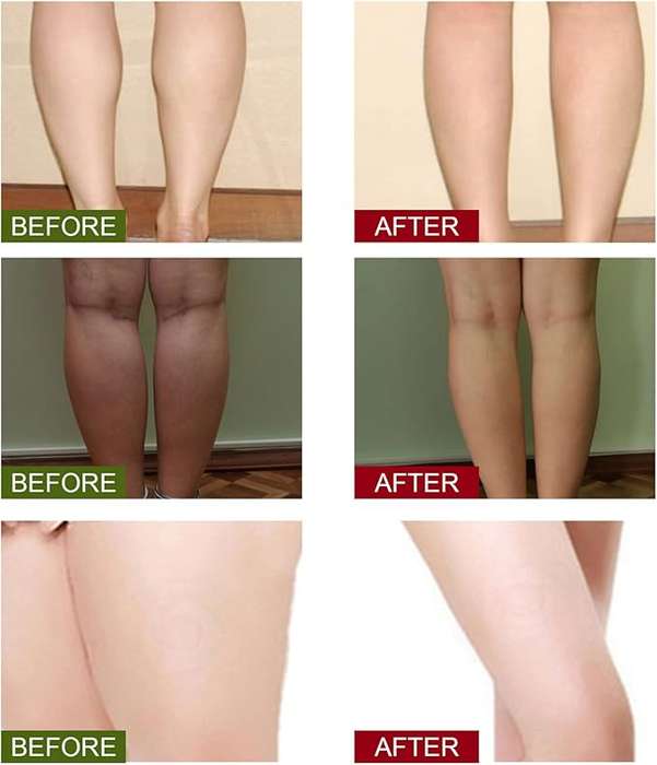 Detox Foot Patches