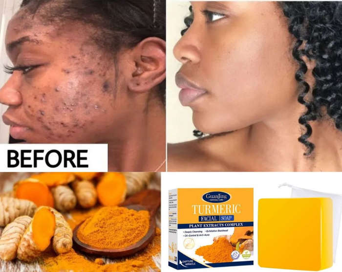 Korean Turmeric Facial Soap