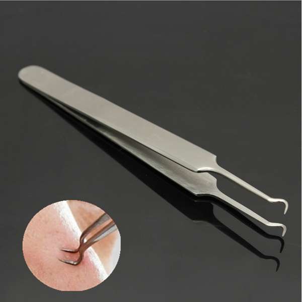 Stainless Steel Blackhead Acne Remover Nipper Pimple Removal