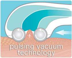 Pulsing technology diagram