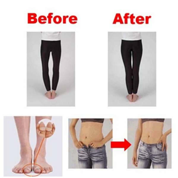 2Pcs Magnetic Silicon Toe Ring Slimming Loss Weight Massager