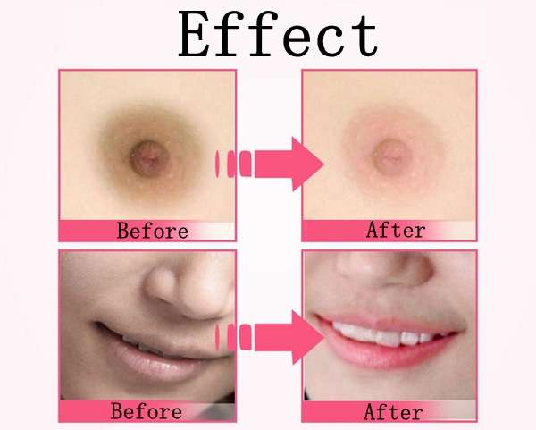 AFY Lip Private Part Nipple Bleaching Whitening Fresh Up Pinkish Cream