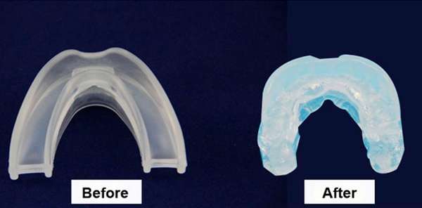 Anti Snoring Mouthpiece Sleeping Aid Snore Stopper Mouth Guard Device 