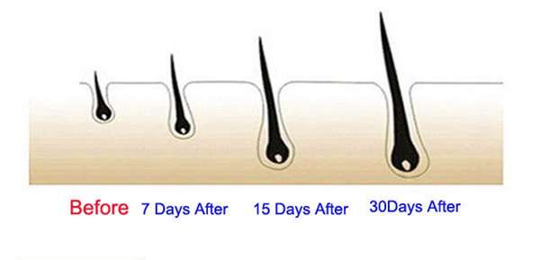 5ML Eyelash Growth Liquid Thicker Lengthening Treatment