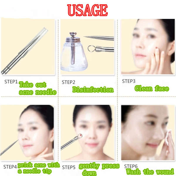 4Pcs 8cm Stainless Acne Blackhead Pimple Extraction Needle Removal Pin