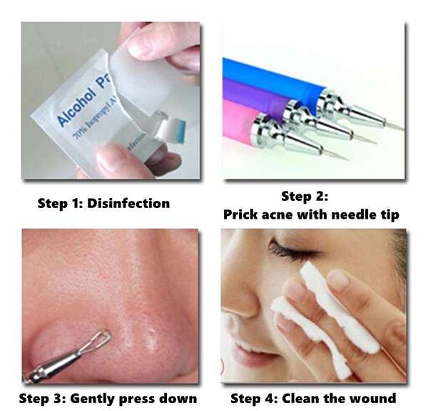 Detachable Acne Blackhead Pimple Extraction Needle Removal Pin