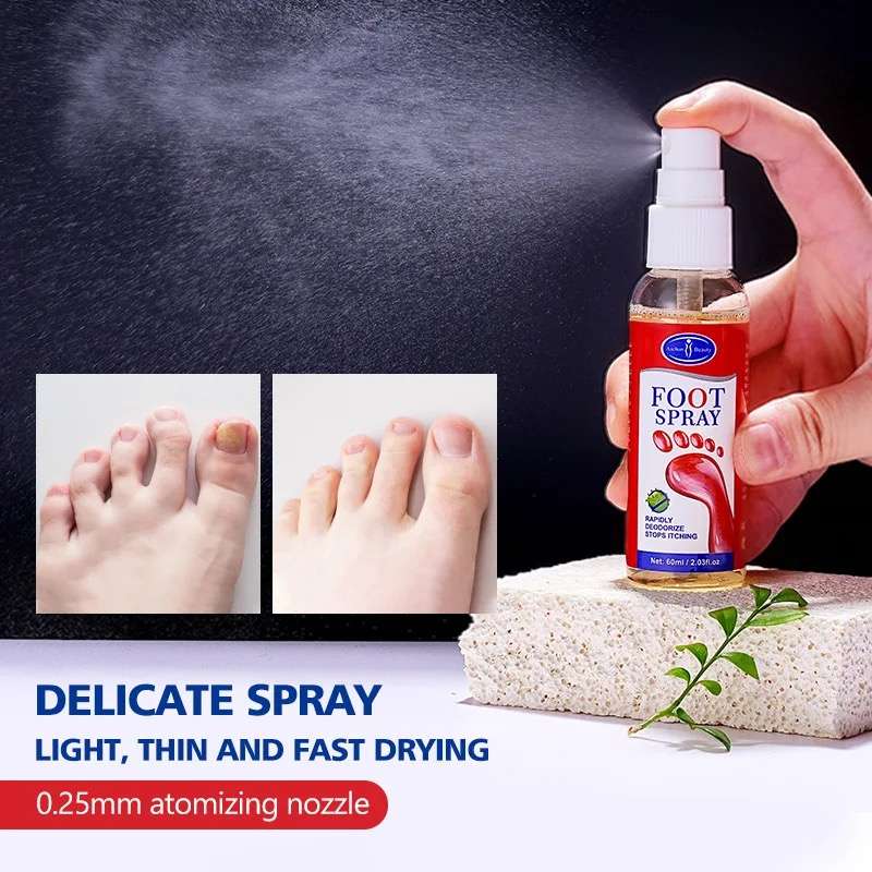 Foot Fissure Treatment Odor Removal Anti Sweat Fungus Foot Spray 60ml