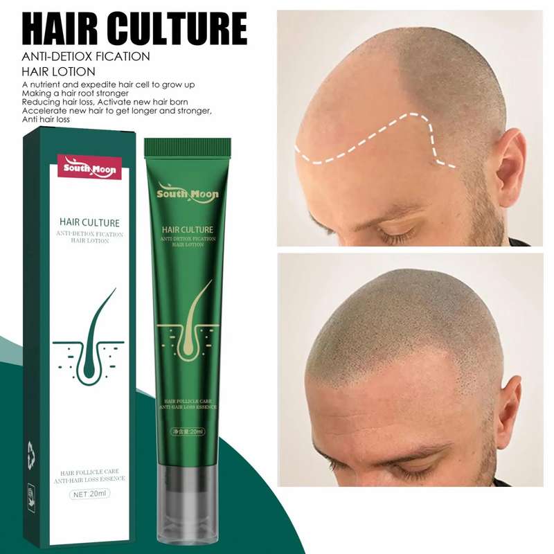 Hair Culture Anti Detox Fication Hair Lotion Growth Essence Serum 20ml