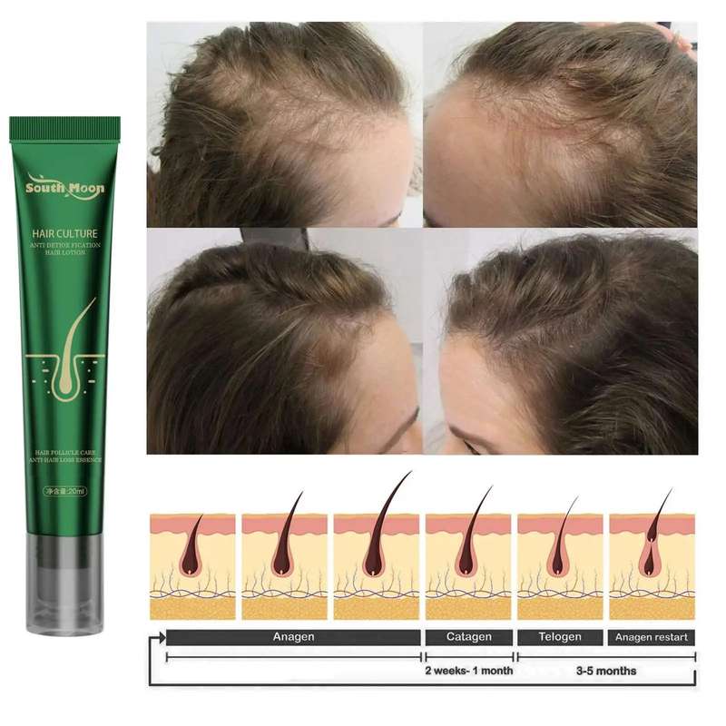 Hair Culture Anti Detox Fication Hair Lotion Growth Essence Serum 20ml