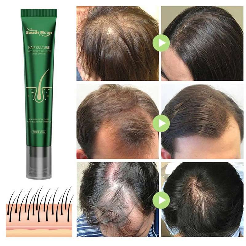 Hair Culture Anti Detox Fication Hair Lotion Growth Essence Serum 20ml
