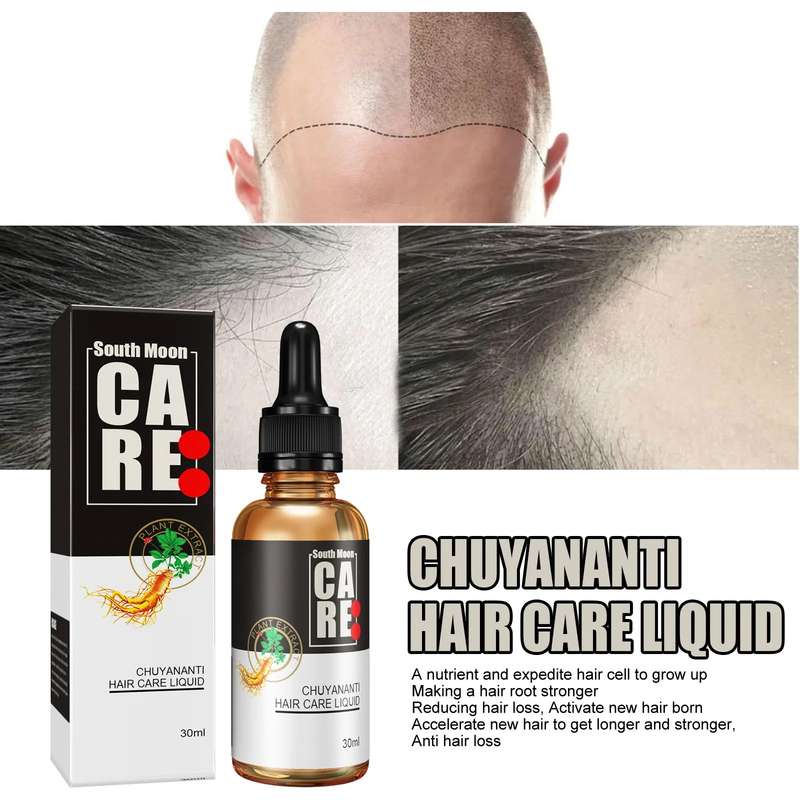 Hair Growth Essential Oil Nourishing Hair Root Scalp Serum 30ml