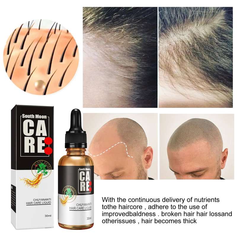 Hair Growth Essential Oil Nourishing Hair Root Scalp Serum 30ml