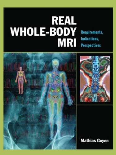 Real Whole-Body MRI: Requirements Indications Perspectives - Mathias Goyen