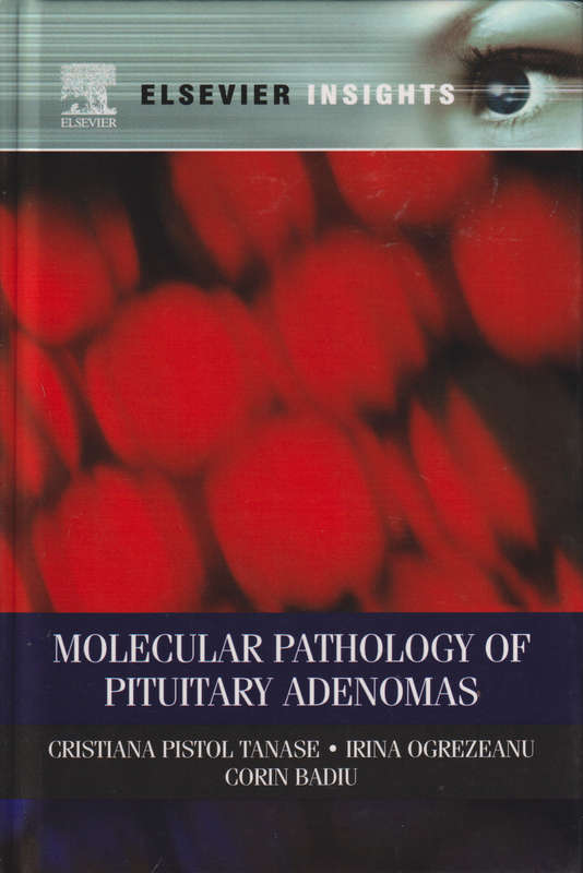 Molecular Pathology of Pituitary Adenomas - Cristiana Tanase