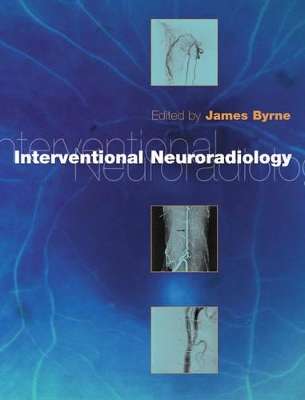 Interventional Neuroradiology - BYRNE,J
